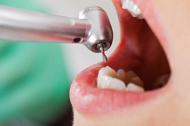 Best Emergency Dental Extractions in Maiden, NC